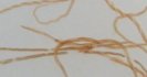 Barbervax? - a vaccine to protect against barber's pole worm