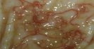 Replacement of resistant worms with susceptible worms - can we do it and is it sustainable?