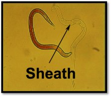 Figure 2. Ex-sheathed L3 larvae. Source: Veterinary Health Research.