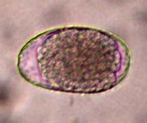 Stongyle type egg