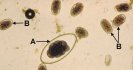 Eastern Australia sheep worm outbreak