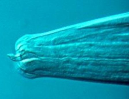 Image: Lancet on barber's pole worm head (Source: J.A. van Wyk, Faculty of Veterinary Science, University of Pretoria & Onderstepoort Veterinary Institute, South Africa)
