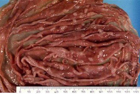 Image: Nodules in the 4th stomach of a sheep caused by brown stomach worm (Source: Dr R Woodgate, Department of Agriculture Western Australia)