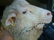 The dotted line shows the jawline, below that is swelling.